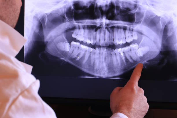 Best Emergency Dental Services for Seniors in Wolfdale, PA