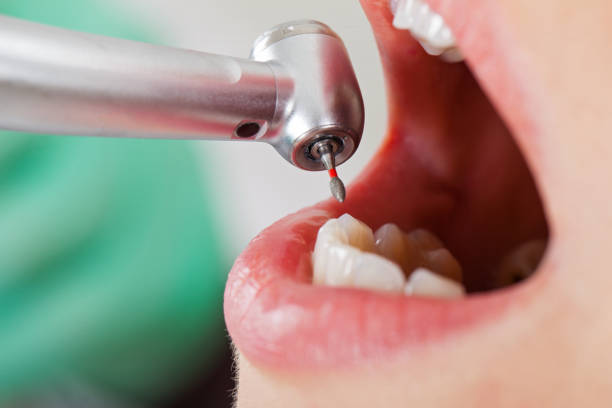 Best Orthodontic Emergency Dentist in Wolfdale, PA